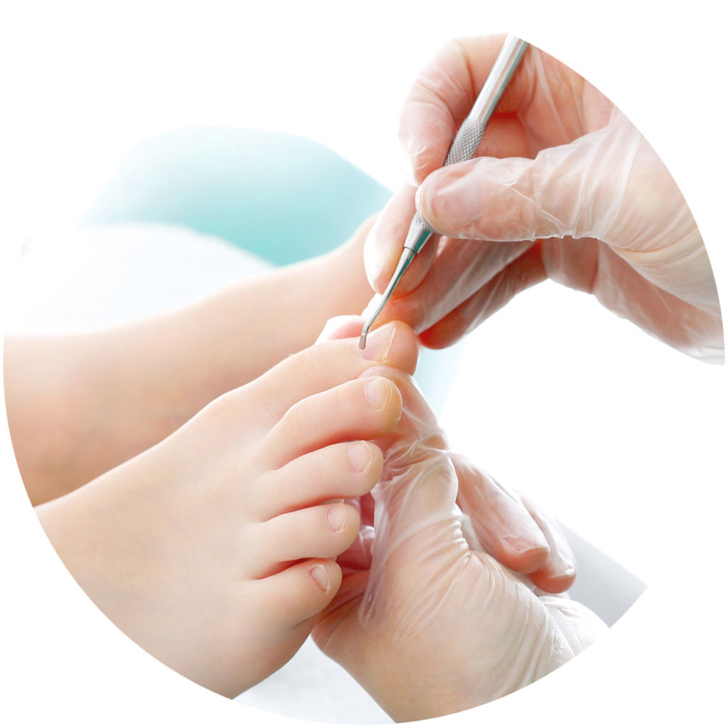 General Foot Toenail Care Northern Rivers Podiatry