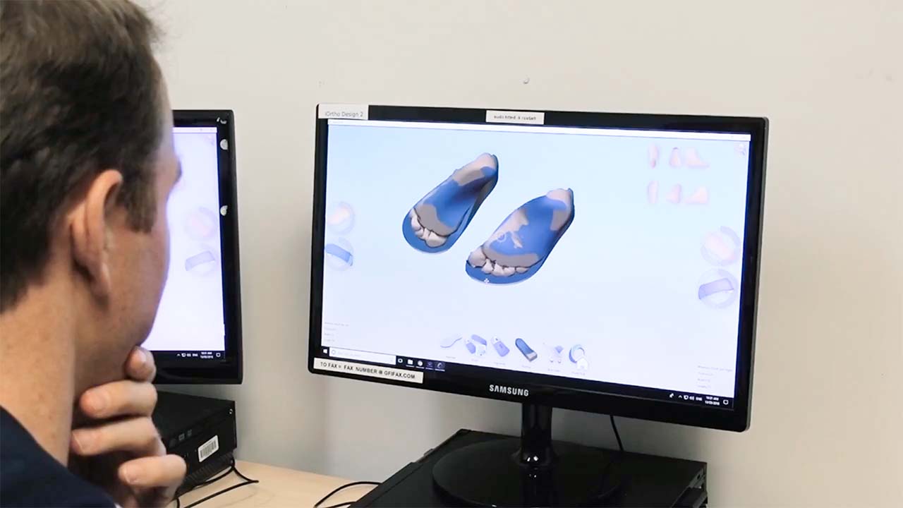 iOrthotics 3D Foot Scan Technology Lab