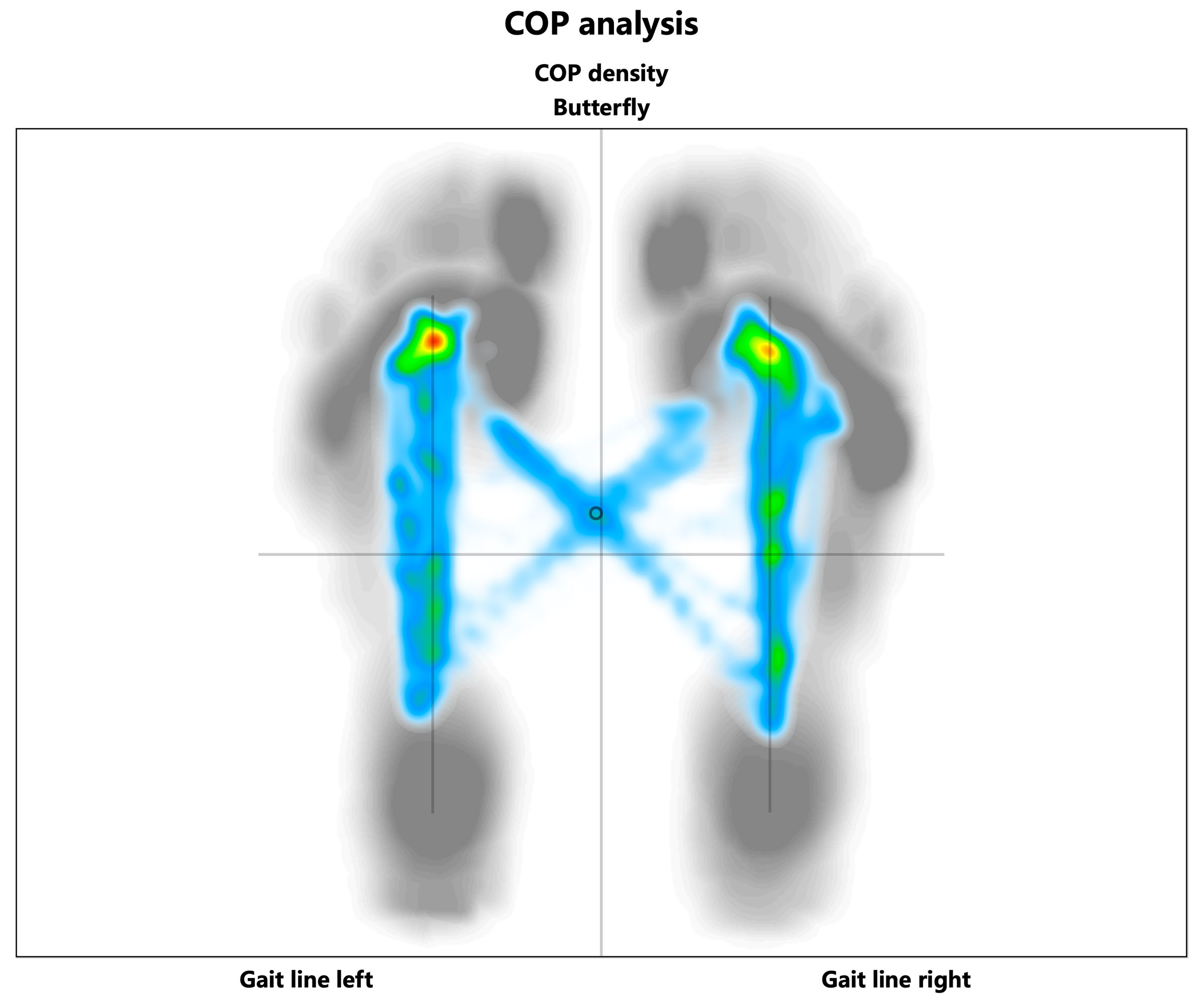 Zebris COP Analysis